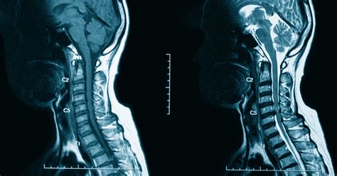 CT With Contrast and MRI With Contrast: Facts to Know • Touchstone Medical Imaging