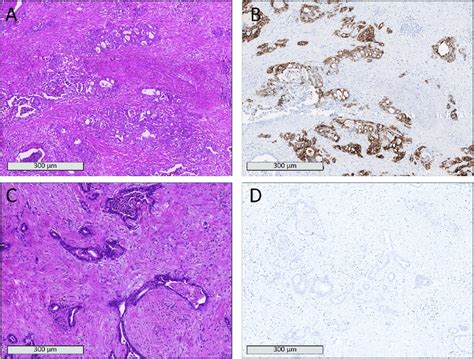 Histopathological samples of two patients showing comparable tissue ...