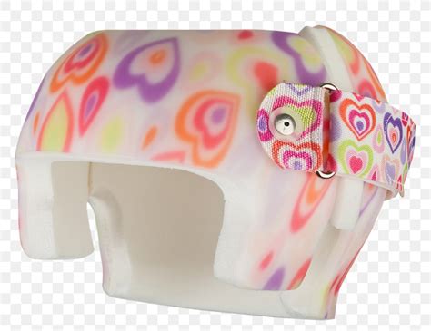 Plagiocephaly Skull Orthotics Scaphocephaly Helmet, PNG, 763x632px, Plagiocephaly, Artificial ...