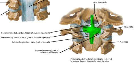 cruciform ligament - Google Search | Joints anatomy, Thoracic vertebrae ...