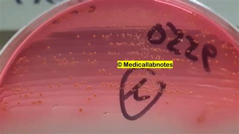 Enterococcal antibiotic resistance mechanisms Archives - Medical Notes