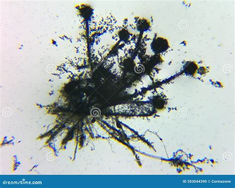 Aspergillus Flavus Mold Conidia Under The Microscope Royalty-Free Stock Image | CartoonDealer ...