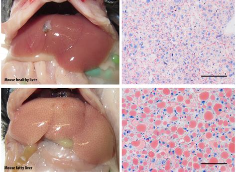 Researchers discover a protein that protects against fatty liver | IRB Barcelona