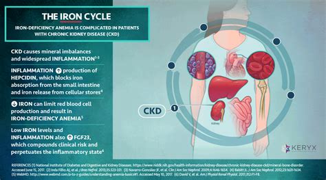 Iron Deficiency & Chronic Kidney Disease - Link Studio, Medical ...