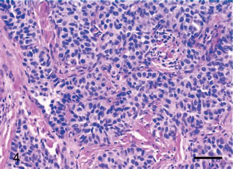 Epithelioid Variant of Hemangioma and Hemangiosarcoma in the Dog, Horse ...