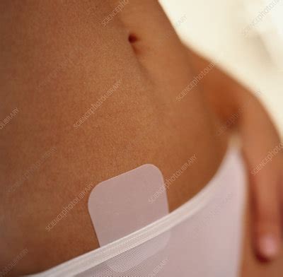 Contraceptive patch - Stock Image - M860/0305 - Science Photo Library