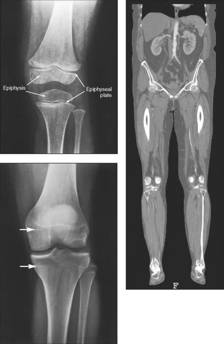 Which Are the Types of Radiographic Projection