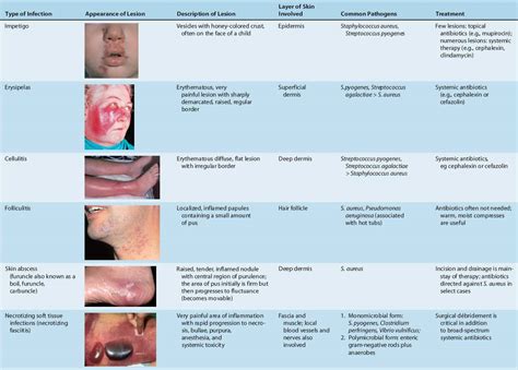 Skin and Soft Tissue Infections | Basicmedical Key