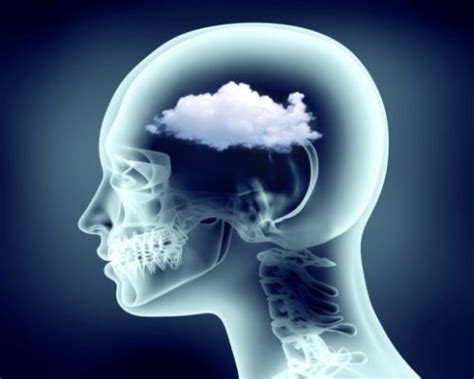 Brain Fog: Causes, Symptoms, and Prevention Tips