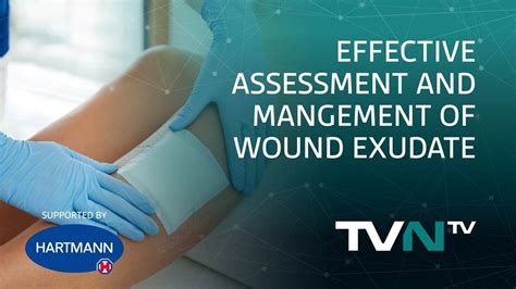 Effective assessment and management of wound exudate - TVN-TV