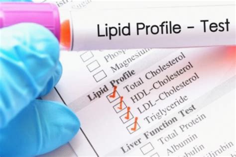 Lipid Profile Test - A Guide To Understanding Cholesterol Levels ...