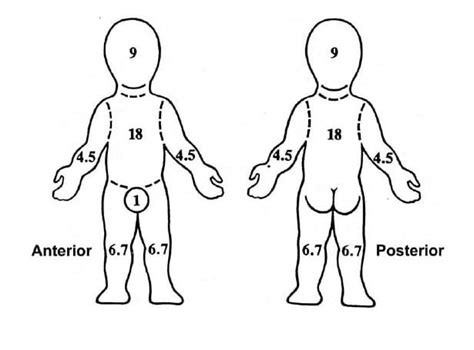 Assessment and Referral of Burn Patients - Department of Surgery