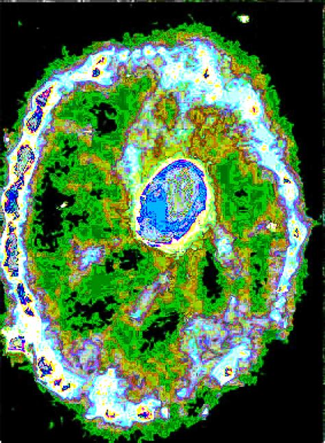 Self-similar structures at different scales behind structure formation on the cosmos