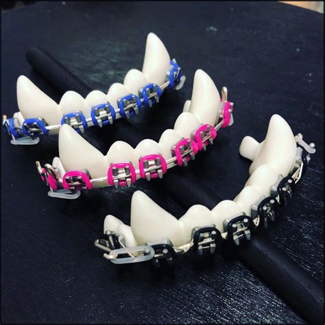 Fursuit Braces lower Canine Set - Etsy