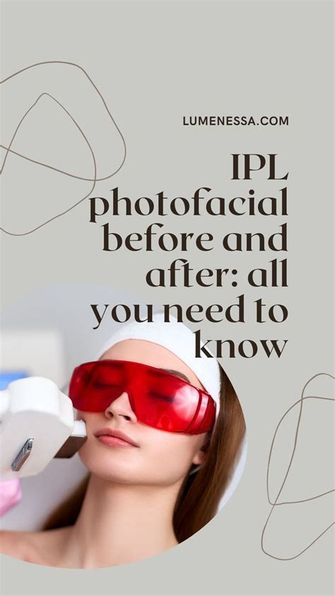 Ipl photofacial before and after results – Artofit