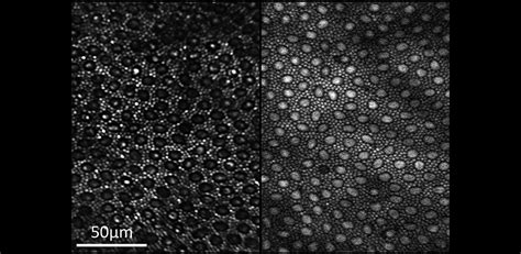 aria: two-photon imaging of the retina