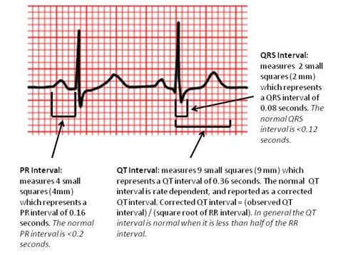 Normal Qrs Time