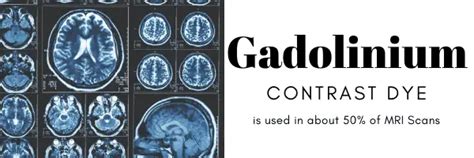 Gadolinium Contrast Dye Allergy - 17 Answer to FAQs