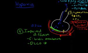 Hypoxia Types, Causes, Treatment, Hypoxia vs Hypoxemia