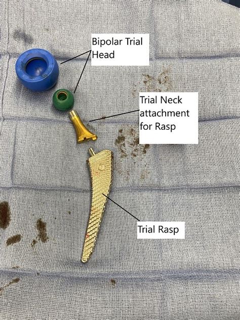 Partial Hip Replacement Vs Total Hip Replacement | Complete Orthopedics | Multiple NY Locations