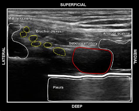 Ultrasound image showing the muscular and vascular structures in the... | Download Scientific ...