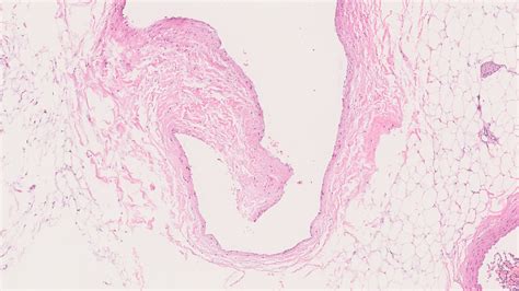 Blood vessels – Normal Histology – NUS Pathweb :: NUS Pathweb