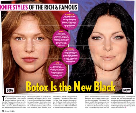 Laura Prepon Plastic Surgery Before And After - vrogue.co