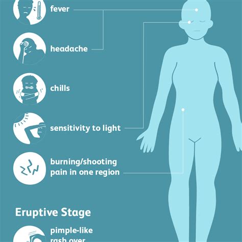 Shingles Symptoms