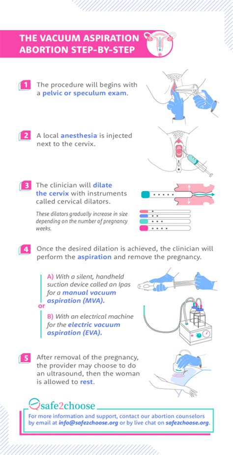 MVA - Manual Vacuum Aspiration Safe Abortion | safe2choose