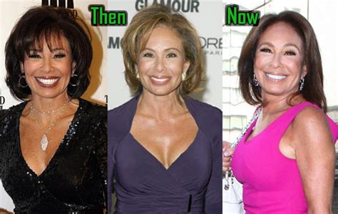 Jeanine Pirro Plastic Surgery: Facelift, Boob Job, Before After ...