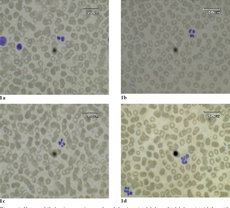 Figure 1 from A STEREOLOGICAL STUDY ON AZUROPHILIC AND SPECIFIC GRANULES IN NEUTROPHILS OF ...