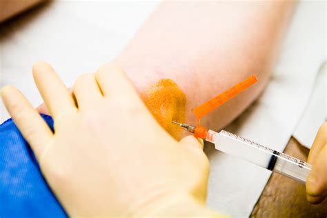 Injections to Relieve Knee Pain (2022)