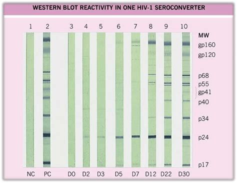 Western Blot Technique: Principle, Steps, Uses • Microbe Online