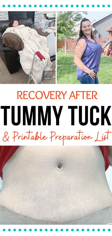 Tummy Tuck Preparation List & Recovery - We Got The Funk