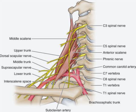 Pinched Nerve From a Car Accident - Pro Chiro