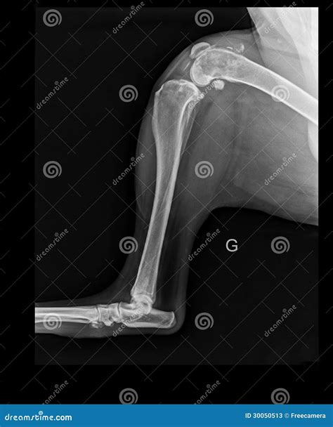 DOG THIGHBONE SARCOMA X-RAY Stock Photos - Image: 30050513