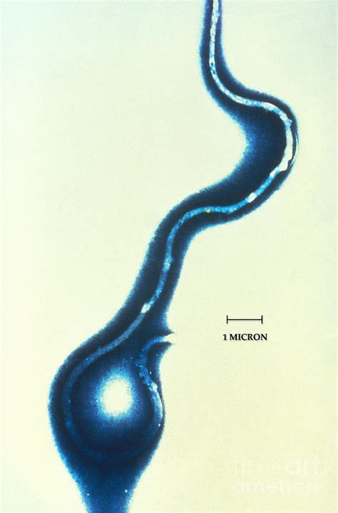 Borrelia Burgdorferi Lyme Disease Photograph by Science Source - Fine Art America