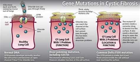 Cystic Fibrosis Genetics: First Structural Map of Cystic Fibrosis Protein