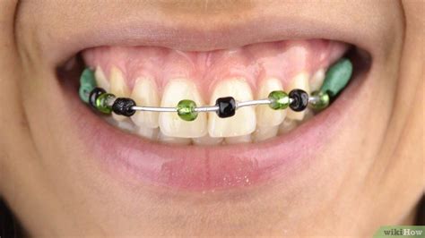 How to Make Fake Braces: 11 Steps (with Pictures)