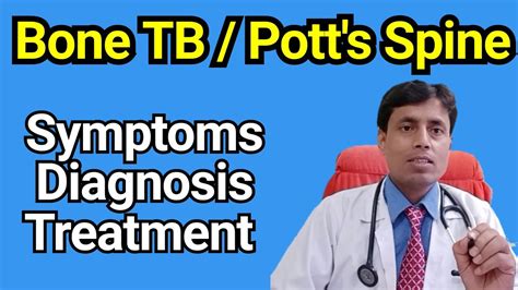 Bone TB Treatment // Spine TB treatment // Potts Spine treatment // Dr ...