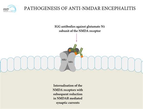 Anti-Nmda Receptor Encephalitis : Anti-NMDA Receptor Encephalitis ...