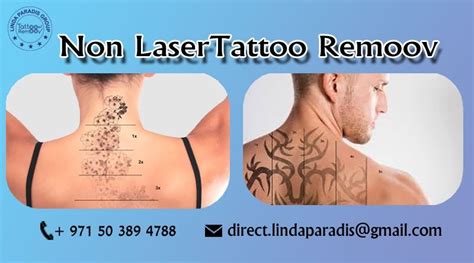 Share more than 67 magnetic tattoo removal - in.cdgdbentre