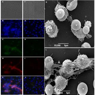 Azurophilic Granules Contain the Azurosome Complex | Download Scientific Diagram