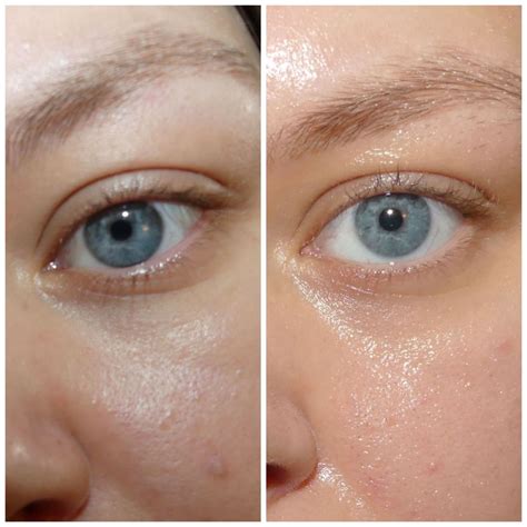 Before and After Retinol Eye Serum - Beauty Insider Community