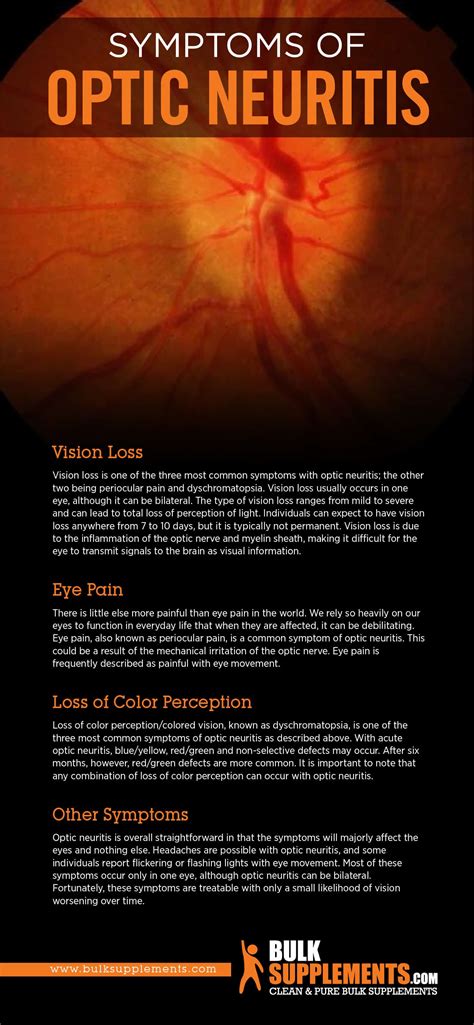 Optic Neuritis: Symptoms, Causes & Treatment