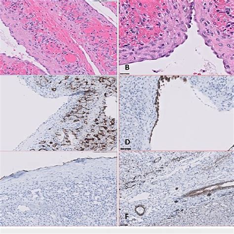 Representative histology from Case 1 and Case 2 Representative sections ...