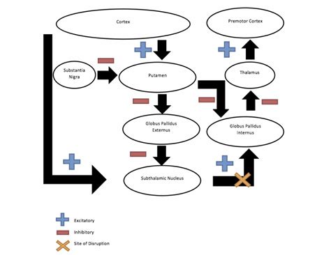 Cureus | Acute Hemiballismus as the Presenting Feature of Parietal Lobe ...