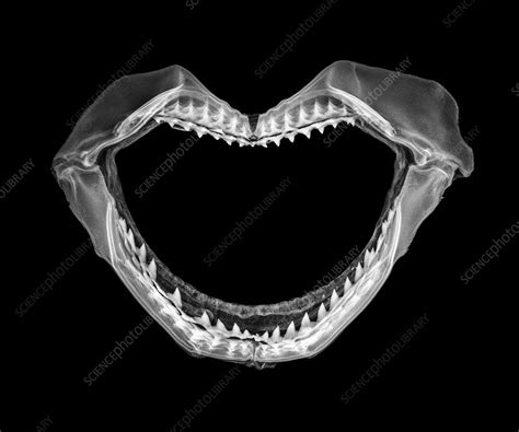 Shark jaws, X-ray - Stock Image - C021/9006 - Science Photo Library