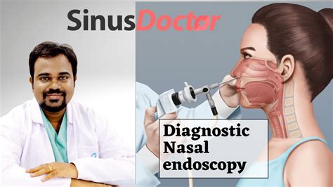 What Is A Nasal Endoscopy Procedure? (Indications, Side, 44% OFF