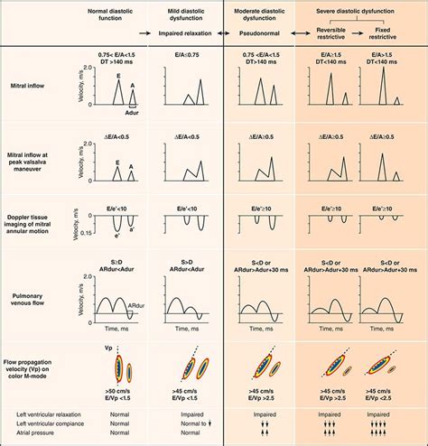 diastolic dysfunction | Dr.S.Venkatesan MD